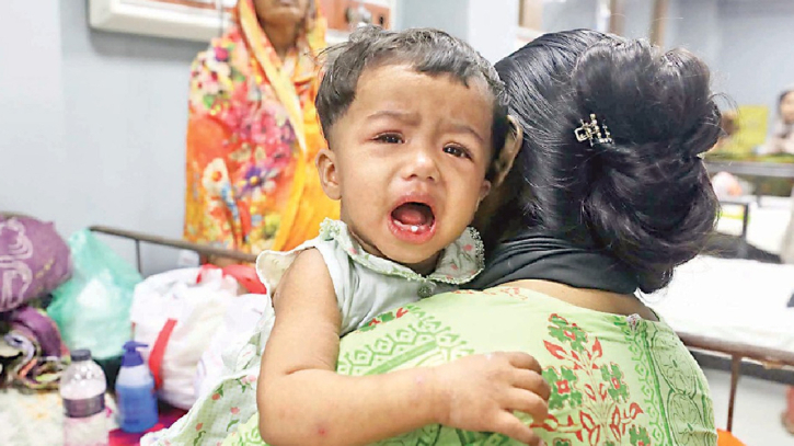 হাম ও হামের উপসর্গ নিয়ে আরও ৫ শিশুর মৃত্যু