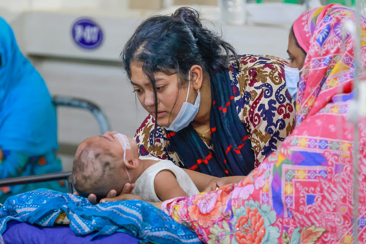 হাম ও হামের উপসর্গে আরও ১১ শিশুর মৃত্যু