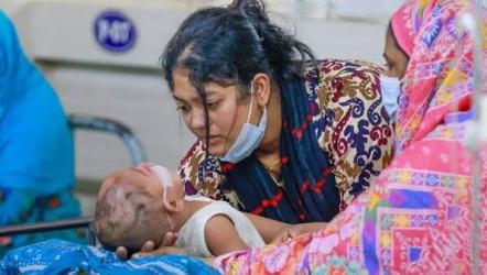হাম ও হামের উপসর্গে প্রাণ গেল আরও ৪ শিশুর