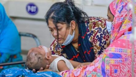 হাম ও হামের উপসর্গে আরও ৭ জনের মৃত্যু